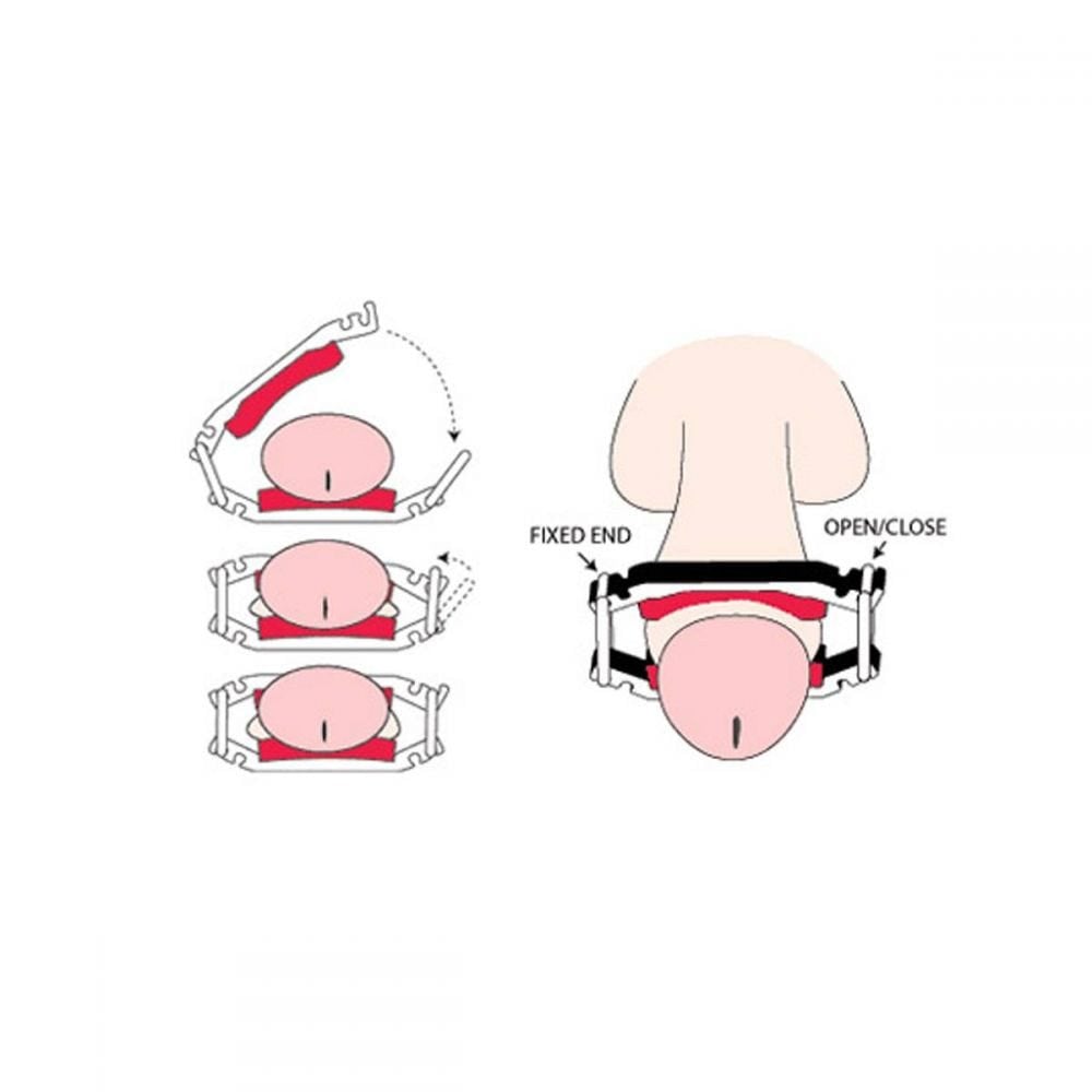 Dribblestop Male Urinary Incontinence Clamps 2 Pack